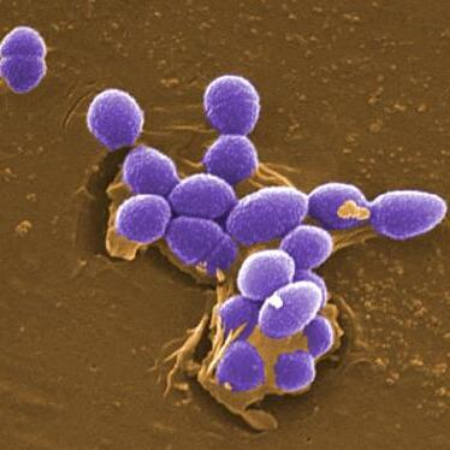 Imagen para la categoría Enterococcus