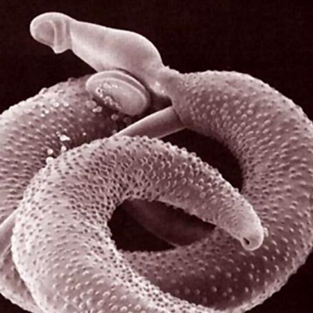 Imagen para la categoría Schistosoma