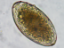 Imagen de 990149 BAControlH Fasciola hepatica