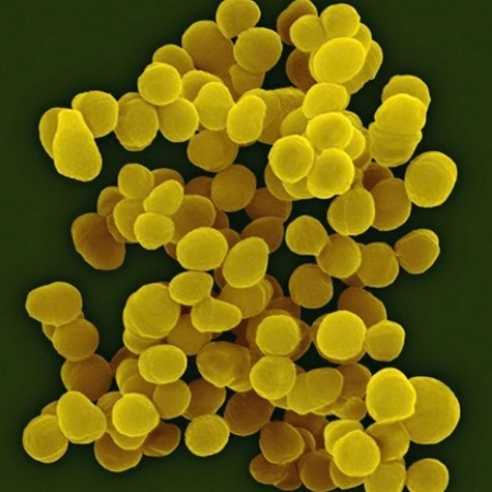 Imagen para la categoría Aerococcus
