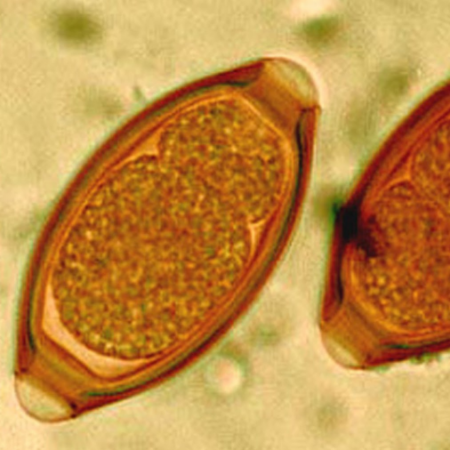 Imagen para la categoría Trichuris